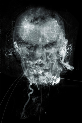 J. Konrad Schmidt - AV Defekt - Selbstportrait